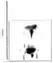 Fig. 18 - Methods and Apparatus for Creating Particle Derivatives of HDL with Reduced Lipid Content