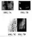 Fig. 10 - Bone tropic peptides