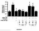 Fig. 04 - Modulation of the Expression of Estrogen Receptors for the Prevention or Treatment of Heart Disease