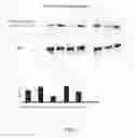 Fig. 02 - Methods for the treatment of diabetes-associated dyslipdemia