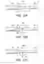 Fig. 07 - Therapeutic method and therapeutic system used with steps for approaching to lesion using overtube