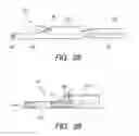 Fig. 15 - Therapeutic method and therapeutic system used with steps for approaching to lesion using overtube