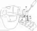 Fig. 01 - Retractor system
