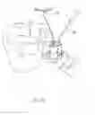 Fig. 10 - Retractor system