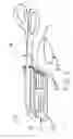 Fig. 05 - Attachable surface electrode for laryngeal electromyography