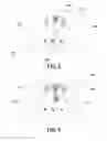 Fig. 03 - Magnetic Resonance Spectroscopy