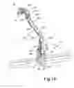 Fig. 22 - DEVICE FOR PRECISION POSITIONING OF INSTRUMENTS AT A MRI SCANNER