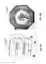 Fig. 11 - Integrated PET-MRI scanner