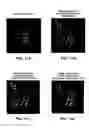 Fig. 12 - Integrated PET-MRI scanner