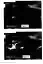 Fig. 05 - Inter-frame processing for contrast agent enhanced medical diagnostic ultrasound imaging