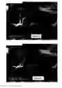 Fig. 06 - Inter-frame processing for contrast agent enhanced medical diagnostic ultrasound imaging
