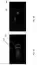Fig. 06 - MEDICAL IMAGING LENS SYSTEM, AND METHOD WITH HIGH-EFFICIENCY LIGHT COLLECTION AND COLLINEAR ILLUMINATION