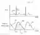 Fig. 04 - Detection of Blood Flow Using Emitted Light Absorption