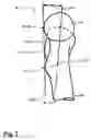 Fig. 03 - Method and apparatus for computer-assisted femoral head resurfacing