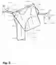 Fig. 04 - Method and apparatus for computer-assisted femoral head resurfacing