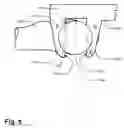 Fig. 06 - Method and apparatus for computer-assisted femoral head resurfacing