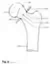 Fig. 07 - Method and apparatus for computer-assisted femoral head resurfacing