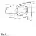 Fig. 08 - Method and apparatus for computer-assisted femoral head resurfacing