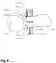 Fig. 09 - Method and apparatus for computer-assisted femoral head resurfacing