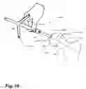 Fig. 11 - Method and apparatus for computer-assisted femoral head resurfacing
