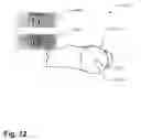 Fig. 13 - Method and apparatus for computer-assisted femoral head resurfacing