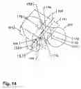 Fig. 15 - Method and apparatus for computer-assisted femoral head resurfacing