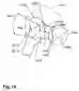 Fig. 16 - Method and apparatus for computer-assisted femoral head resurfacing