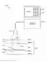 Fig. 01 - Method and system for noninvasive face lifts and deep tissue tightening