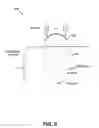Fig. 13 - Method and system for noninvasive face lifts and deep tissue tightening