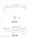 Fig. 21 - Method and system for noninvasive face lifts and deep tissue tightening