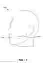 Fig. 25 - Method and system for noninvasive face lifts and deep tissue tightening