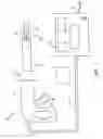 Fig. 02 - ULTRASONIC SURGICAL INSTRUMENT