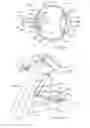 Fig. 06 - THERAPEUTIC DEVICE FOR INDUCING BLOOD PRESSURE MODULATION