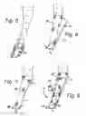 Fig. 03 - Leg splint