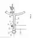 Fig. 04 - Device for guiding the leg during a hip operation, particularly during an endoprosthesis implantation