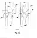 Fig. 04 - Methods and apparatus for leak detection in blood processing systems