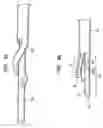 Fig. 10 - Splitable tip catheter with bioresorbable adhesive