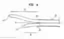 Fig. 13 - Splitable tip catheter with bioresorbable adhesive