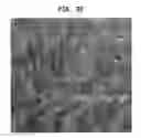 Fig. 35 - Methods And Devices For Fractional Ablation Of Tissue