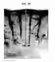 Fig. 49 - Methods And Devices For Fractional Ablation Of Tissue