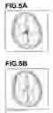 Fig. 06 - Similar case search apparatus and method, and recording medium storing program therefor