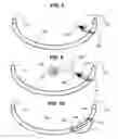 Fig. 05 - Airway imaging system