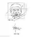 Fig. 05 - Method and device for non-invasive ventilation with nasal interface
