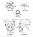 Fig. 10 - Method and device for non-invasive ventilation with nasal interface