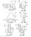 Fig. 14 - Method and device for non-invasive ventilation with nasal interface