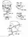 Fig. 16 - Method and device for non-invasive ventilation with nasal interface