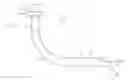 Fig. 01 - Tracheostomy tube
