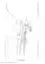 Fig. 03 - Tracheostomy tube