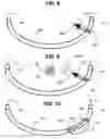 Fig. 05 - Imaging via the airway