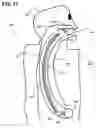 Fig. 17 - Imaging via the airway